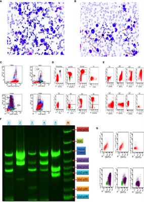 The Molecular Role of HIF1α Is Elucidated in Chronic Myeloid Leukemia